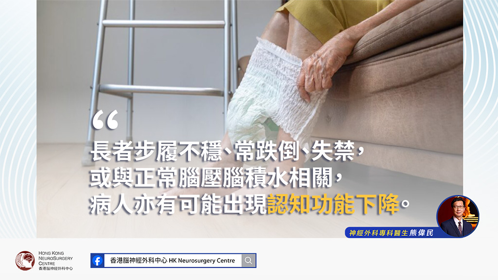懷疑患上正常腦壓腦積水的病人在穿紙尿片
