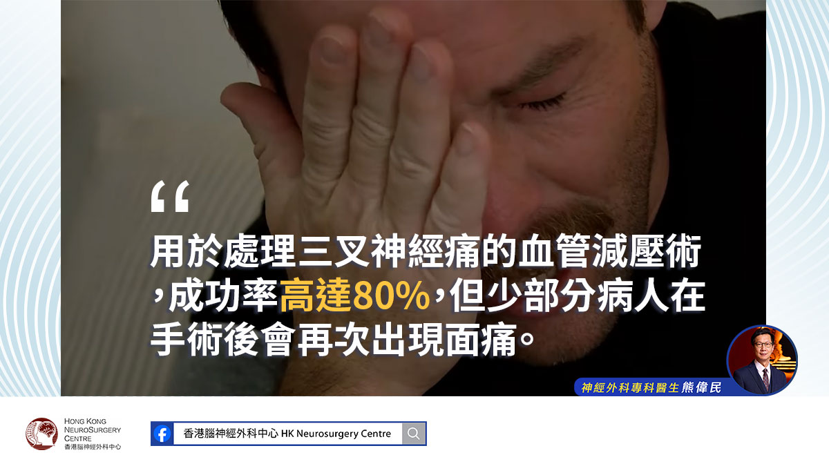 三叉神經痛病人感到面部被電擊