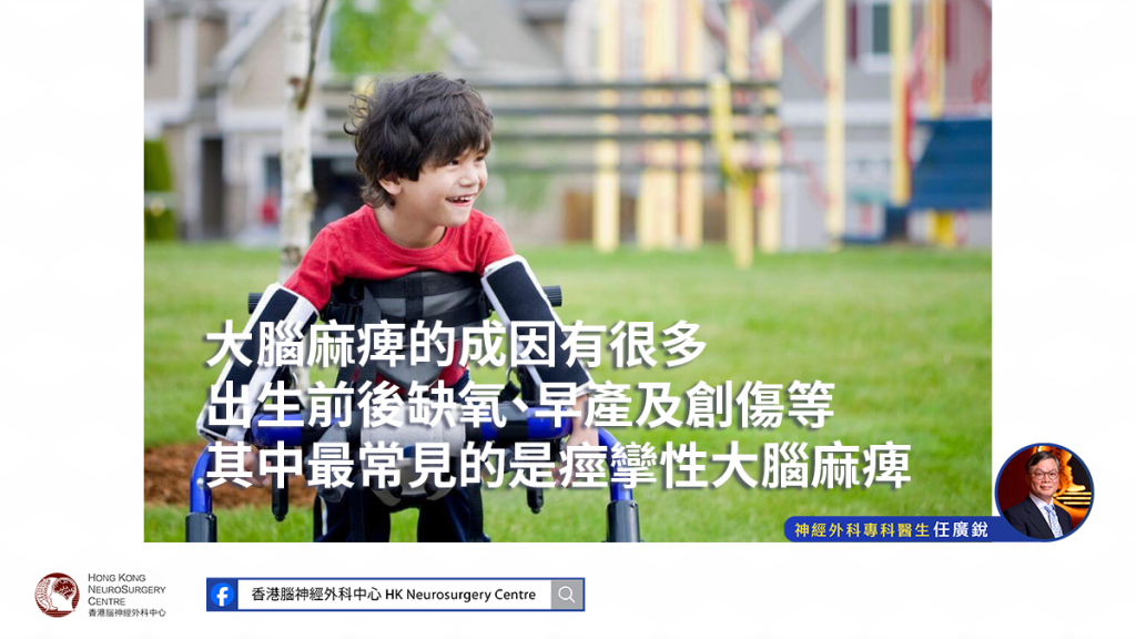 大腦麻痺影響肌肉張力 六歲病童或可考慮手術方案