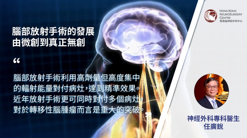 腦部放射手術的發展 由微創到真正無創