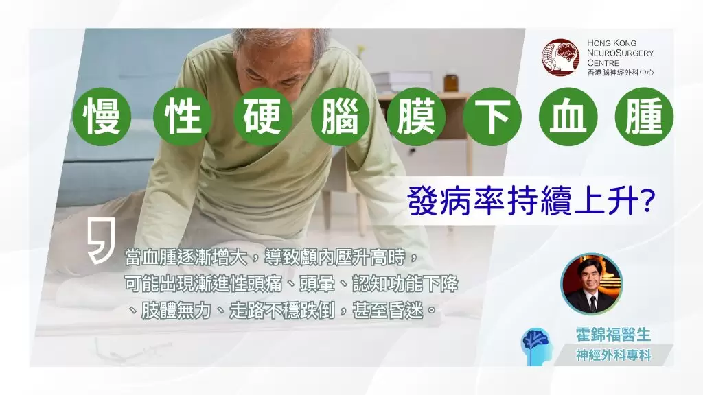 慢性硬腦膜下血腫 | 創新微創導管手術如何治療慢性硬腦膜下血腫？