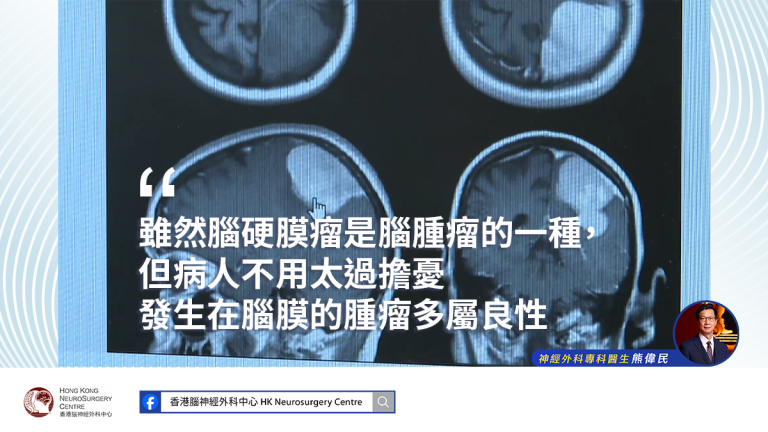 原來是腦硬膜瘤靜悄悄搞破壞？