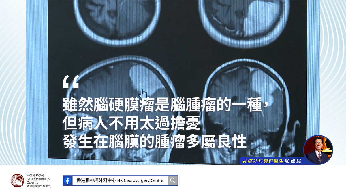 電腦掃描顯示硬膜瘤