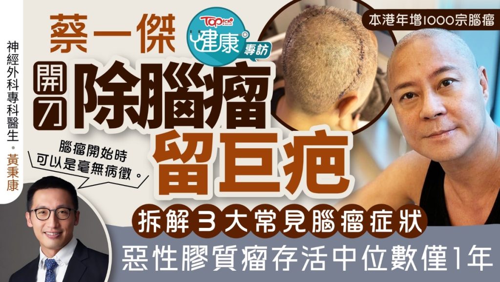 腦腫瘤丨蔡一傑開刀除腦瘤留巨疤 醫生拆解三大常見腦瘤症狀