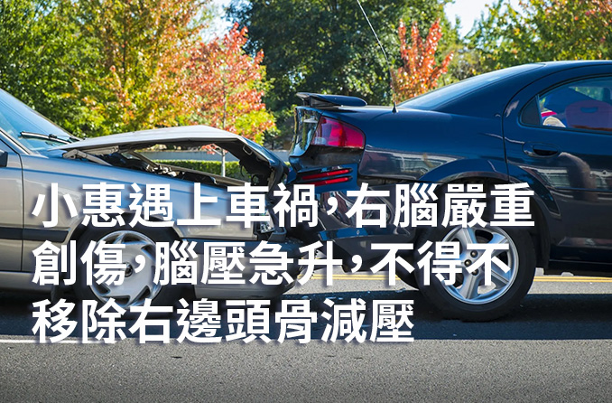 腦創傷 | 顱骨成形術僅重塑頭顱弧度？