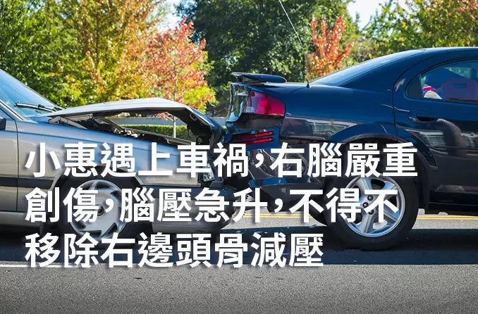 腦創傷 | 顱骨成形術僅重塑頭顱弧度？