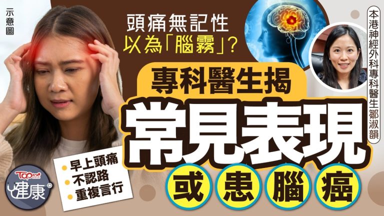 腦癌｜頭痛無記性以為「腦霧」？神經外科專科醫生揭常見表現或患腦癌