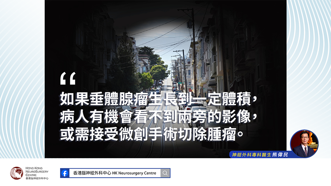 神經外科醫生熊偉民解釋神野變差可與垂體腺瘤增大有關